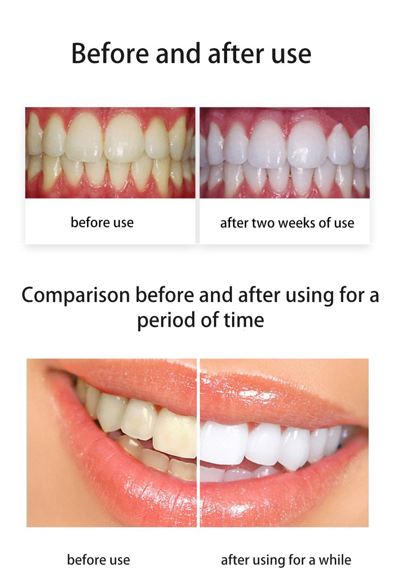 Clareamento Dental SparkleSmile